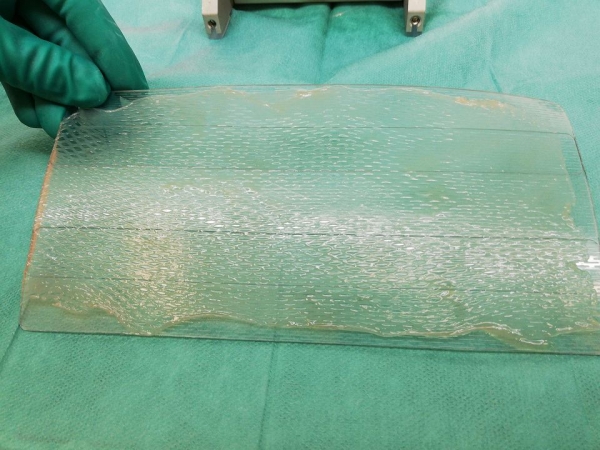 Błony owodniowe pomagają leczyć oparzenia i niegojące się rany. To opatrunek idealny!